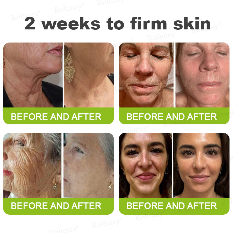 👍🌟💫Made and shipped from the UK 💫Rolimey® Botox & Vita-A Retinol Shot Wrinkle-Lift Tightening cream - Last Day Promotion 70% OFF