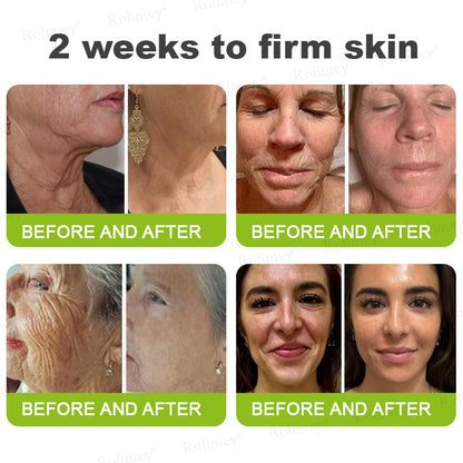 👍🌟💫Made and shipped from the UK 💫Rolimey® Botox & Vita-A Retinol Shot Wrinkle-Lift Tightening cream - Last Day Promotion 70% OFF