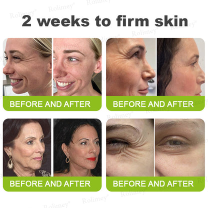 👍🌟💫Made and shipped from the UK 💫Rolimey® Botox & Vita-A Retinol Shot Wrinkle-Lift Tightening cream - Last Day Promotion 70% OFF