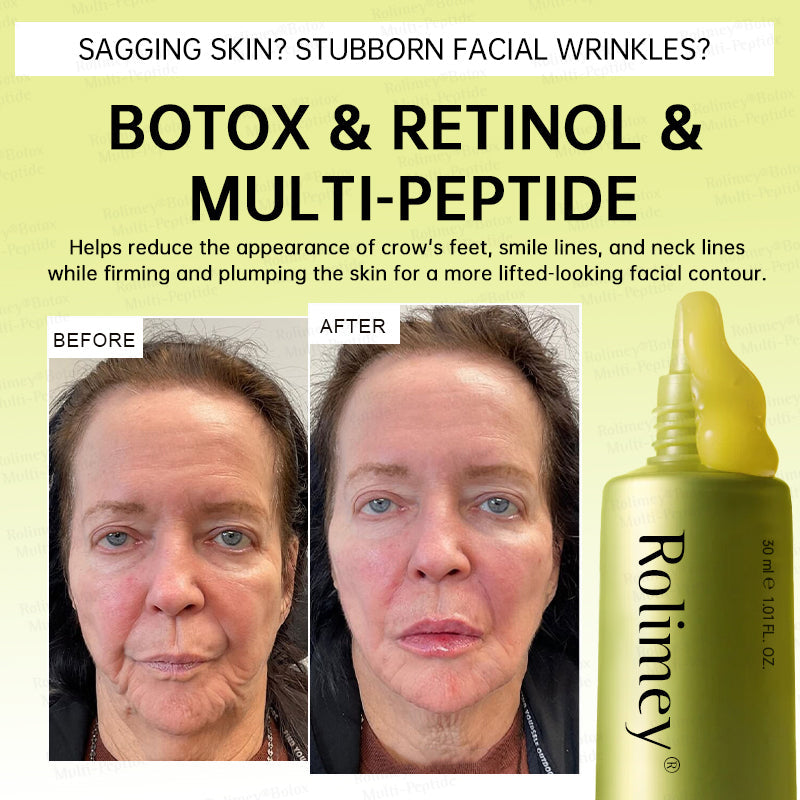 💐🌟Rolimey® Multi-Peptide Retinol Shot Wrinkle-Lift Cream