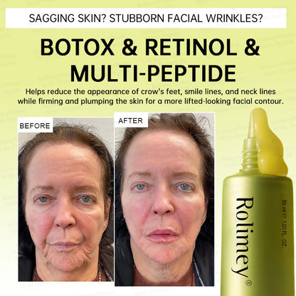 💐🌟Rolimey® Multi-Peptide Retinol Shot Wrinkle-Lift Cream