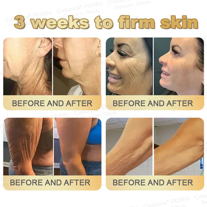 🎁🌟✨UK Celsiora® PDRN Multi-Peptide Firming Serum Stick👩‍🔬LAST DAY 70% OFF