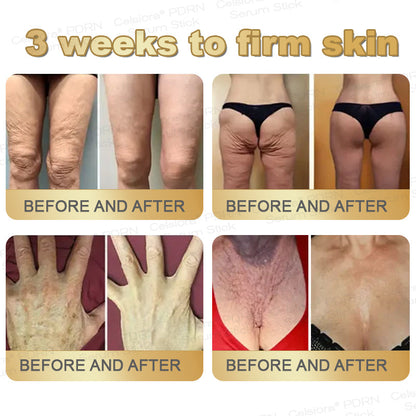 🎁🌟✨UK Celsiora® PDRN Multi-Peptide Firming Serum Stick👩‍🔬LAST DAY 70% OFF