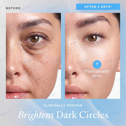 🎖️🥳UK HOT SALE Celsiora® PDRN Anti-Wrinkle Shot – Lift & Firming Cream