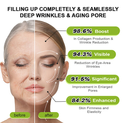 👍🌟💫Made and shipped from the UK 💫Rolimey® Botox & Vita-A Retinol Shot Wrinkle-Lift Tightening cream - Last Day Promotion 70% OFF