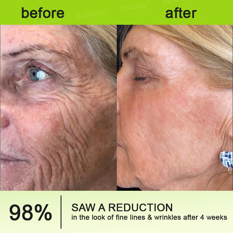 👍🌟💫Made and shipped from the UK 💫Rolimey® Botox & Vita-A Retinol Shot Wrinkle-Lift Tightening cream - Last Day Promotion 70% OFF