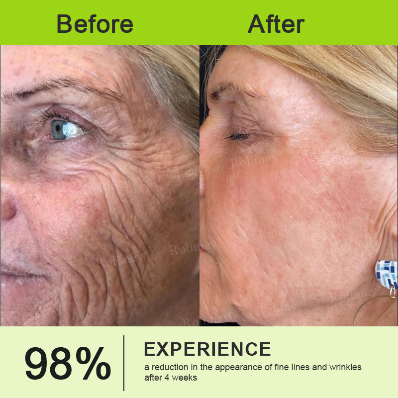 👨‍⚕️Made and shipped from the UK ✅ Rolimey® Botox & Vita-A Retinol Shot Wrinkle-Lift Tightening stick