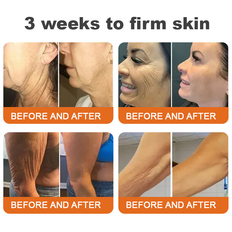 🎄🎁🌟Made and Shipped from UK✨Flysmus® Botox Bee Venom Firming Stick🎄Christmas Special! 70% OFF for a Limited Time!