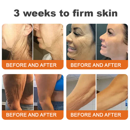 🎄🎁🌟Made and Shipped from UK✨Flysmus® Botox Bee Venom Firming Stick🎄Christmas Special! 70% OFF for a Limited Time!