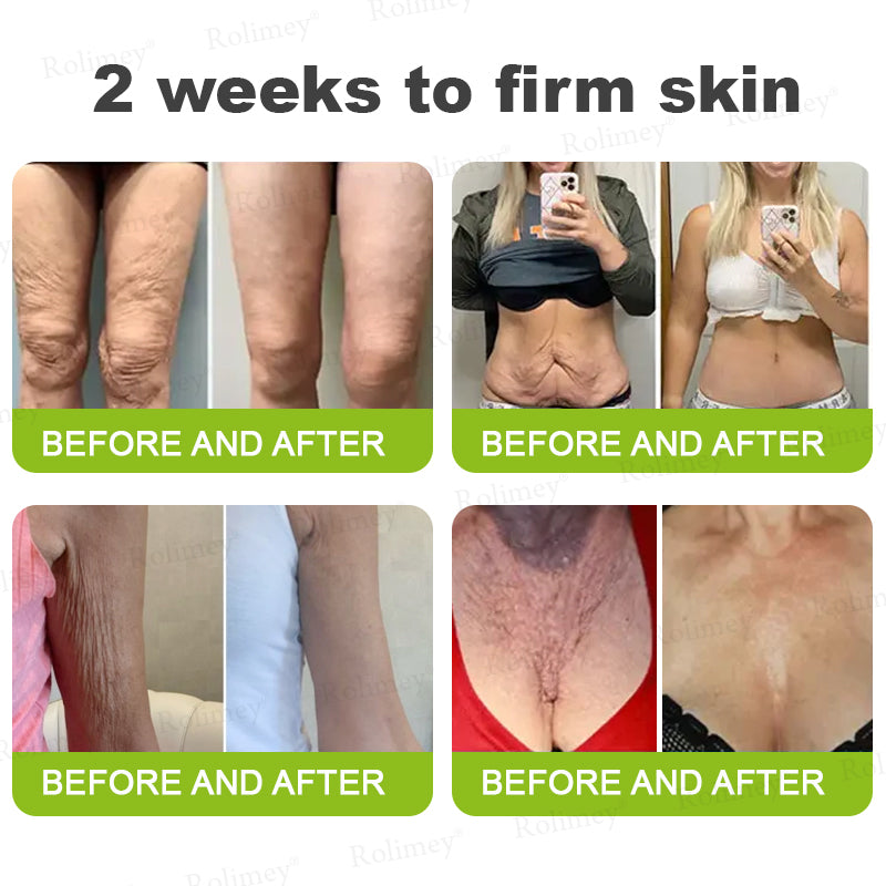 👍🌟💫Made and shipped from the UK 💫Rolimey® Botox & Vita-A Retinol Shot Wrinkle-Lift Tightening cream - Last Day Promotion 70% OFF