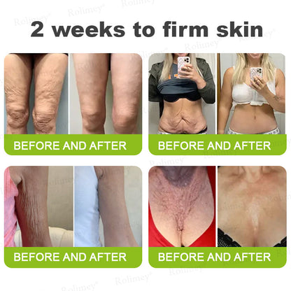 👨‍⚕️Made and shipped from the UK ✅ Rolimey® Botox & Vita-A Retinol Shot Wrinkle-Lift Tightening stick