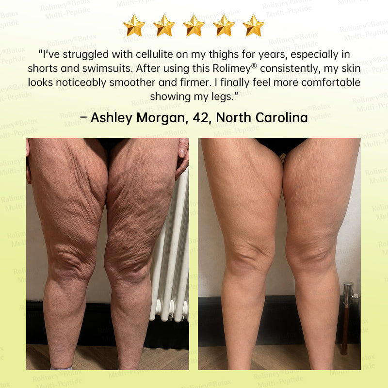 💐🌟Rolimey® Multi-Peptide Retinol Shot Wrinkle-Lift Cream