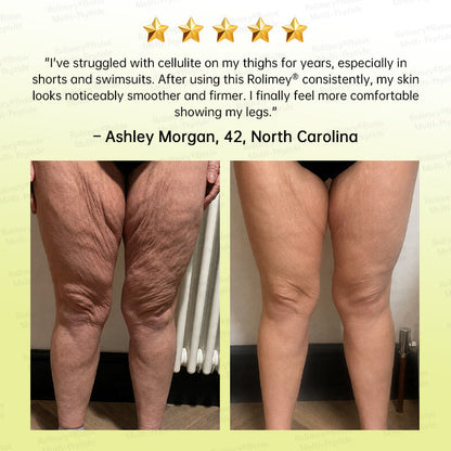 💐🌟Rolimey® Multi-Peptide Retinol Shot Wrinkle-Lift Cream