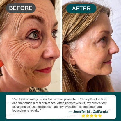 Rolimey® Stem Cell Wrinkle-Lift Tightening Cream