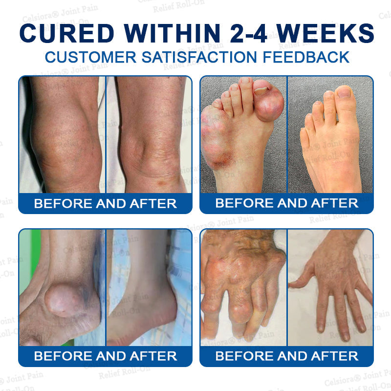👨‍⚕️UK Official Store: Celsiora® BPC-157 Arthritis & Joint Pain Relief Advanced Massage Roll-On-Last Day Promotion 70% OFF
