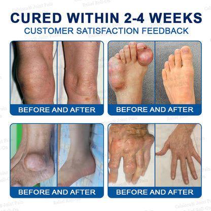 👨‍⚕️UK Official Store: Celsiora® BPC-157 Arthritis & Joint Pain Relief Advanced Massage Roll-On-Last Day Promotion 70% OFF