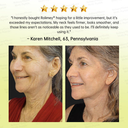 💐🌟Rolimey® Multi-Peptide Retinol Shot Wrinkle-Lift Cream