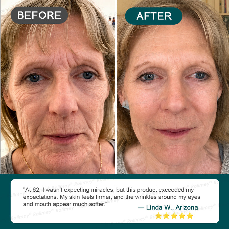Rolimey® Stem Cell Wrinkle-Lift Tightening Cream