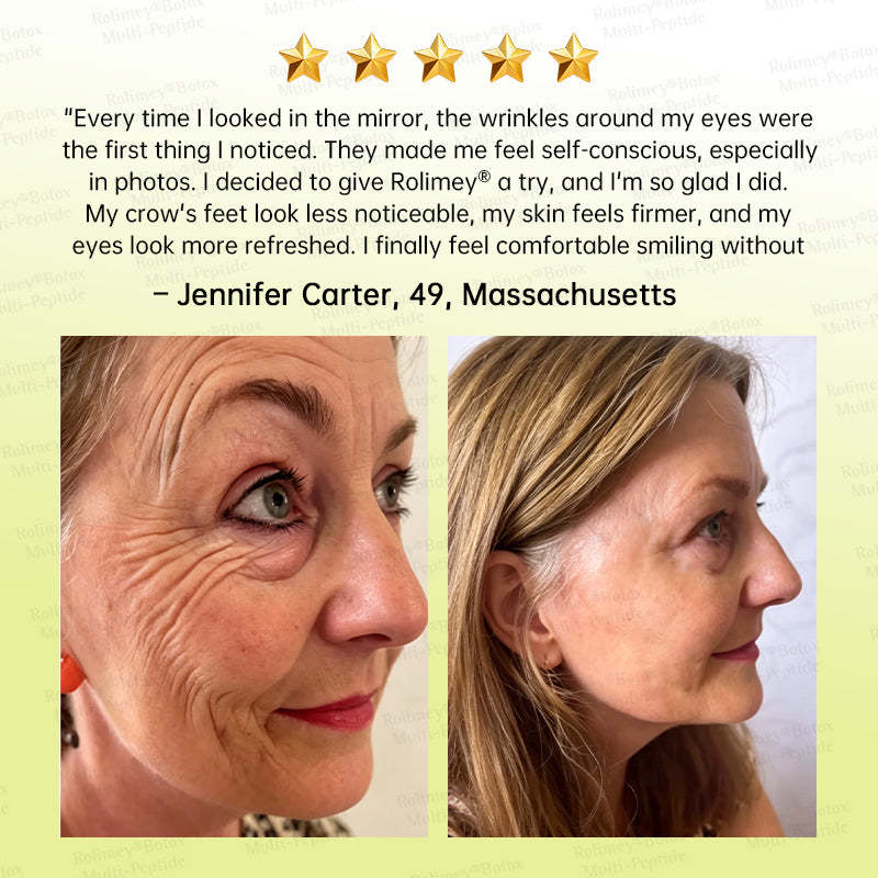 💐🌟Rolimey® Multi-Peptide Retinol Shot Wrinkle-Lift Cream