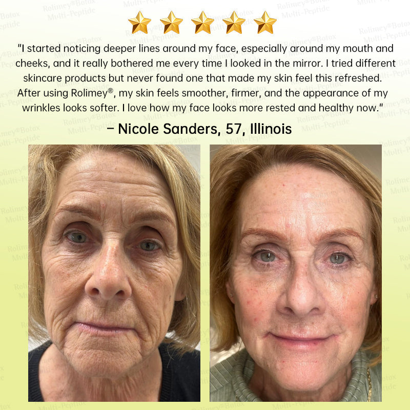 💐🌟Rolimey® Multi-Peptide Retinol Shot Wrinkle-Lift Cream