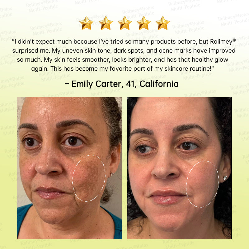 💐🌟Rolimey® Multi-Peptide Retinol Shot Wrinkle-Lift Cream