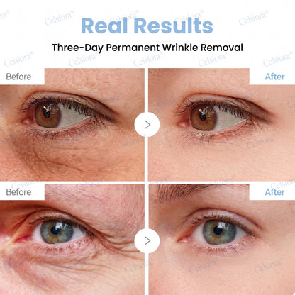 🎖️🥳UK HOT SALE Celsiora® PDRN Anti-Wrinkle Shot – Lift & Firming Cream