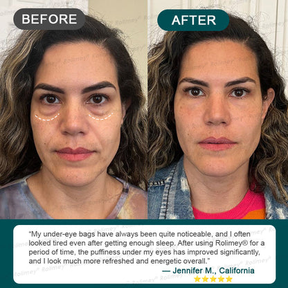 Rolimey® Stem Cell Wrinkle-Lift Tightening Cream