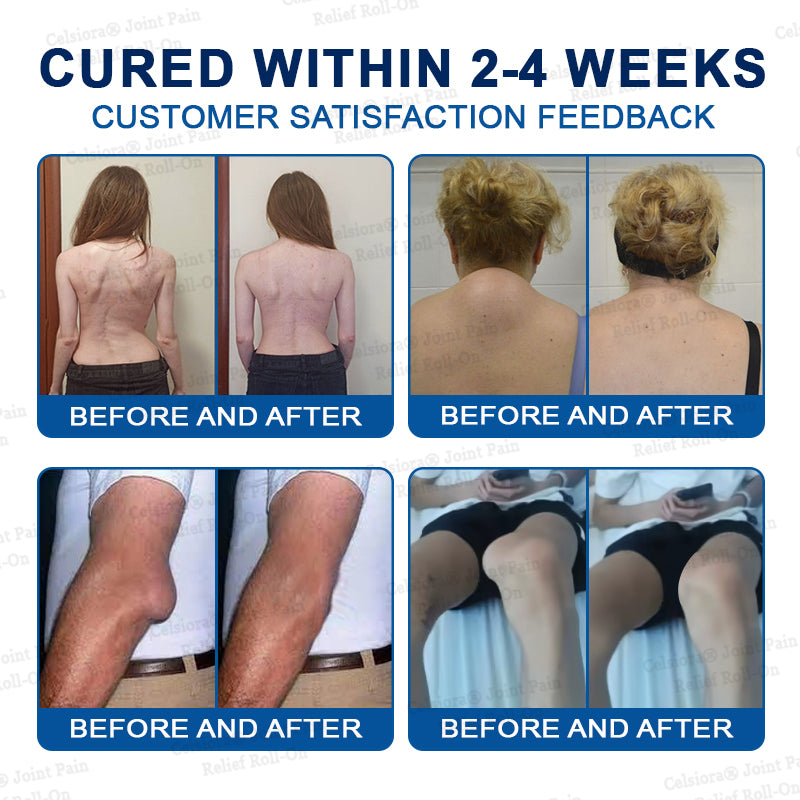 👨‍⚕️UK Official Store: Celsiora® BPC-157 Arthritis & Joint Pain Relief Advanced Massage Roll-On-Last Day Promotion 70% OFF