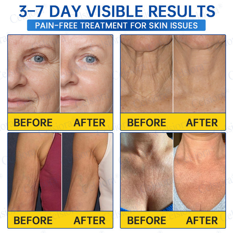 🎖️🥳UK HOT SALE Celsiora® PDRN Anti-Wrinkle Shot – Lift & Firming Cream