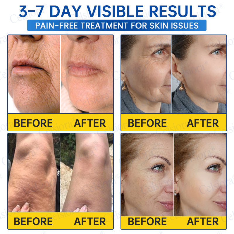 🎖️🥳UK HOT SALE Celsiora® PDRN Anti-Wrinkle Shot – Lift & Firming Cream