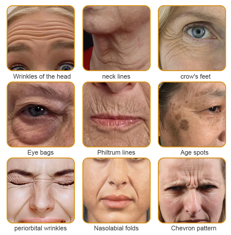 ✨👩‍⚕️MHRA Approved✨Furzero™ Botox Bee Venom Wrinkle Removal Cream-Last Day Promotion 70% OFF