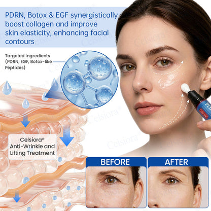 🎖️🥳UK HOT SALE Celsiora® PDRN Anti-Wrinkle Shot – Lift & Firming Cream