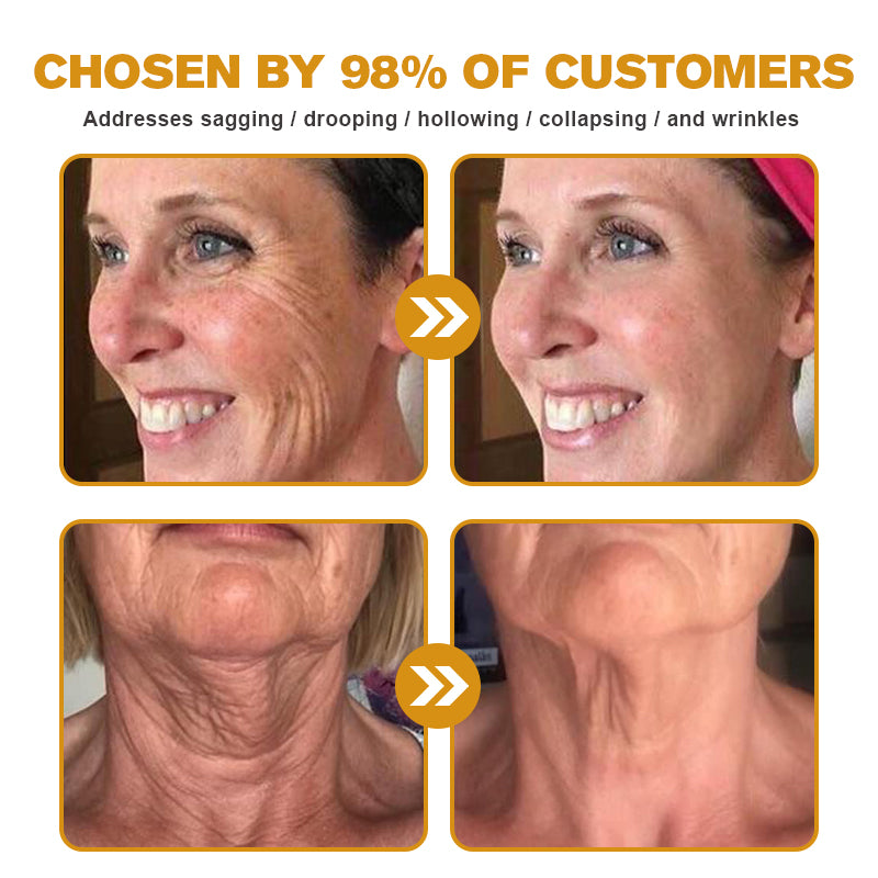 (✅Made and Shipped from UK)✨Furzero™ Botox Bee Venom Wrinkle Removal Cream-Last Day Promotion 70% OFF