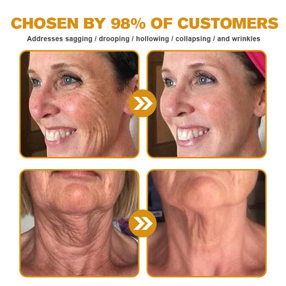 ✨👩‍⚕️MHRA Approved✨Furzero™ Botox Bee Venom Wrinkle Removal Cream-Last Day Promotion 70% OFF