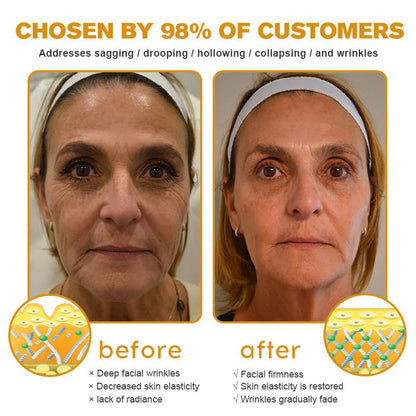 ✨👩‍⚕️MHRA Approved✨Furzero™ Botox Bee Venom Wrinkle Removal Cream-Last Day Promotion 70% OFF