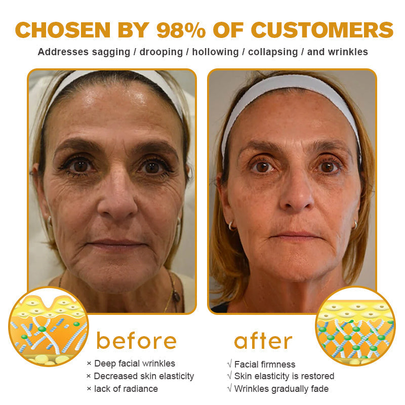 (✅Made and Shipped from UK)✨Furzero™ Botox Bee Venom Wrinkle Removal Cream-Last Day Promotion 70% OFF